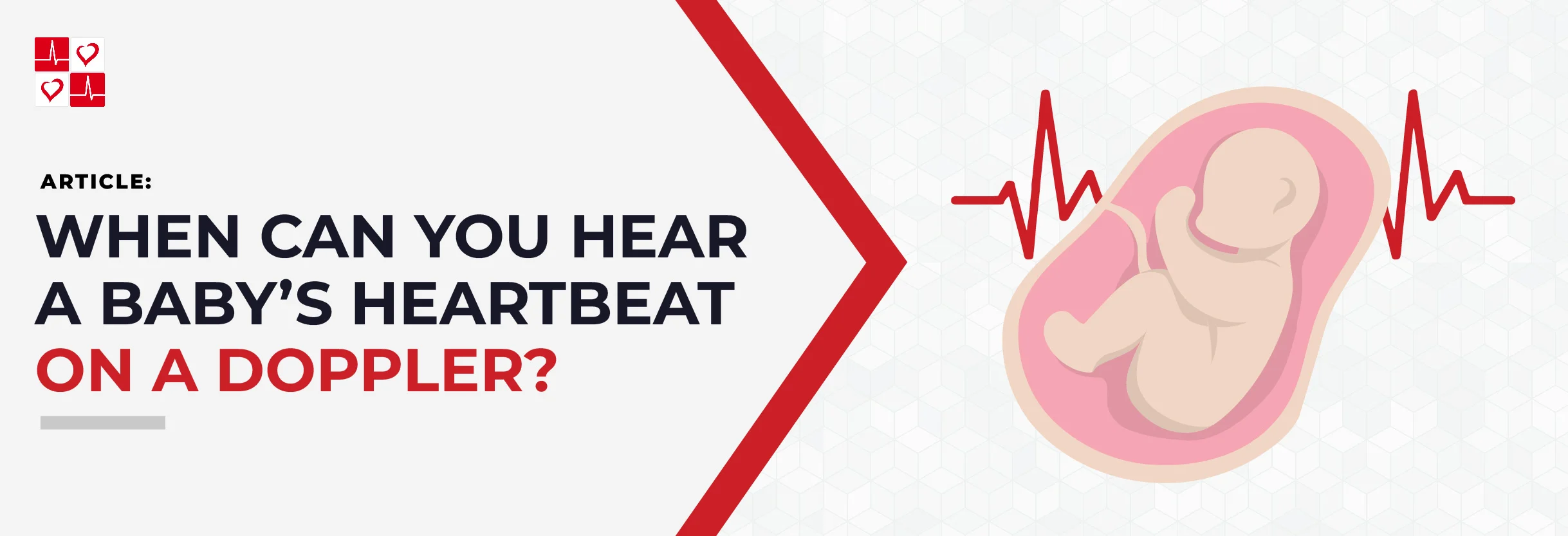 BabysHeartbeatonDoppler_TitleGraphic_New