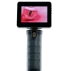 MDPro EZVision Laryngoscope