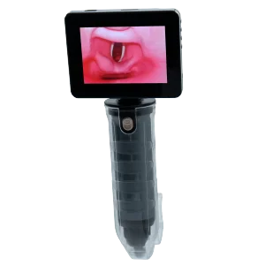 MDPro EZVision Laryngoscope