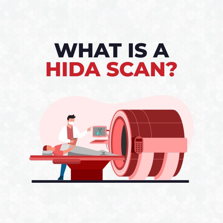 What is a HIDA Scan? CardiacDirect