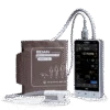Edan iM3s Vital Signs Monitor