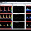 Huntleigh Dopplex Vascular Reporter Software
