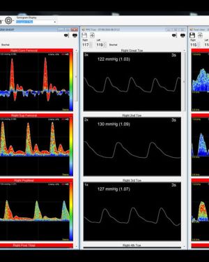 Huntleigh Dopplex Vascular Reporter Software