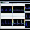 Huntleigh Dopplex Vascular Reporter Software