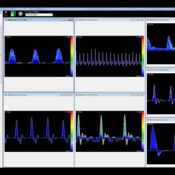 Huntleigh Dopplex Vascular Reporter Software