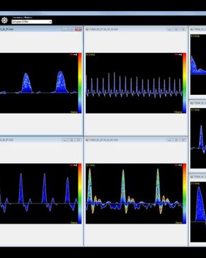 Huntleigh Dopplex Vascular Reporter Software