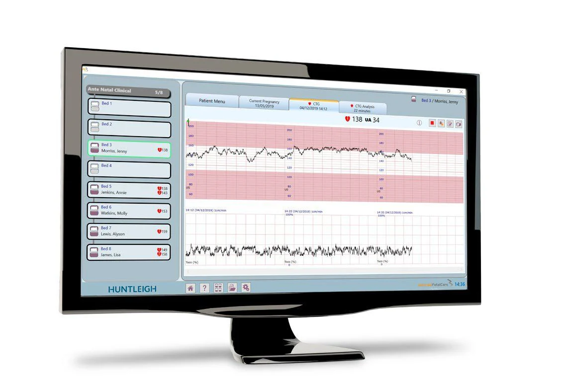 Huntleigh Sonicaid FetalCare3  CTG Viewing & Archiving System
