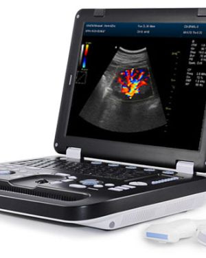 Kaixin DCU50 Diagnostic Ultrasound System