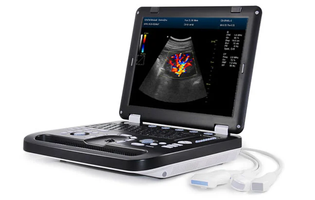 Kaixin DCU50 Diagnostic Ultrasound System