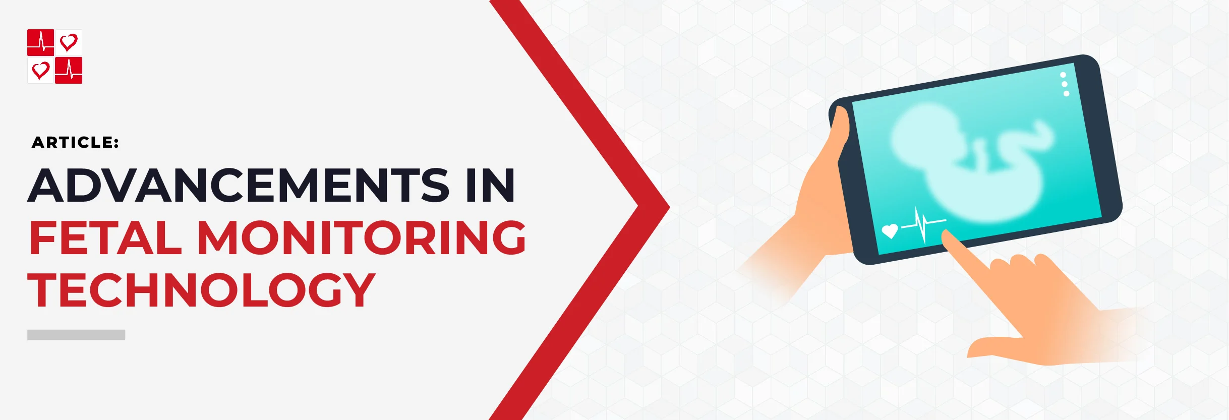 Advancements-in-Fetal-Monitoring-Tech_TitleGraphic