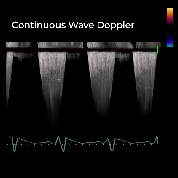 Continuous_Doppler