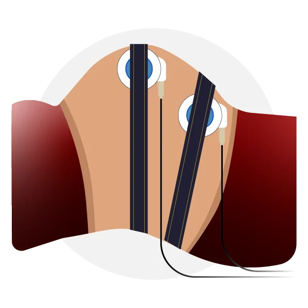 Contraction-Stress-Test_Icon