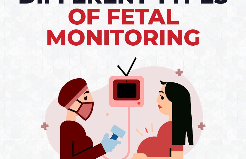 Different-Types-of-Fetal-Monitoring-Article-Cover