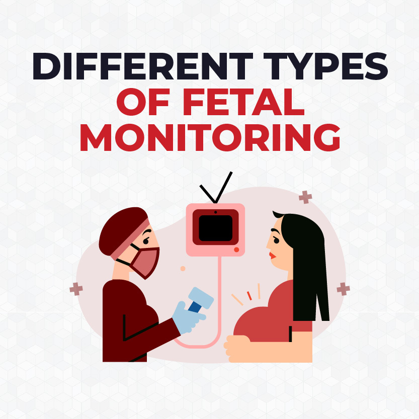 Different Types of Fetal Monitoring: External vs Internal - CardiacDirect