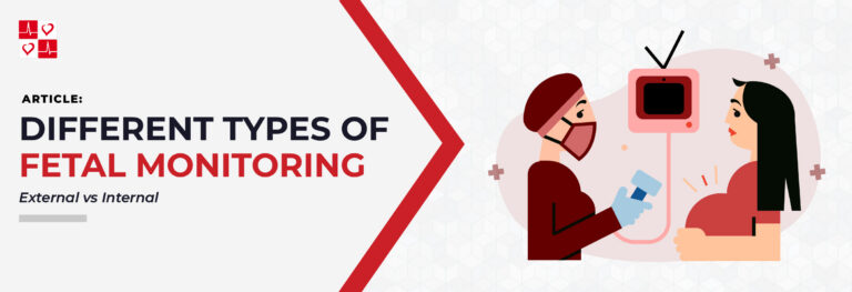 Internal Monitoring Different Types of Fetal Monitoring: External vs Internal - CardiacDirect