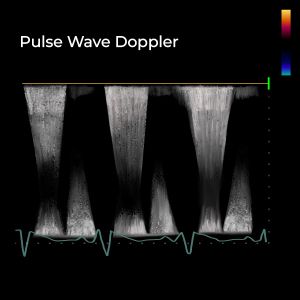 Pulsed_Doppler