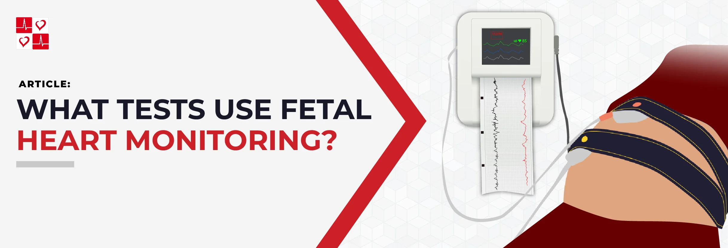 What-Tests-Use-Fetal-Monitoring_TitleGraphic