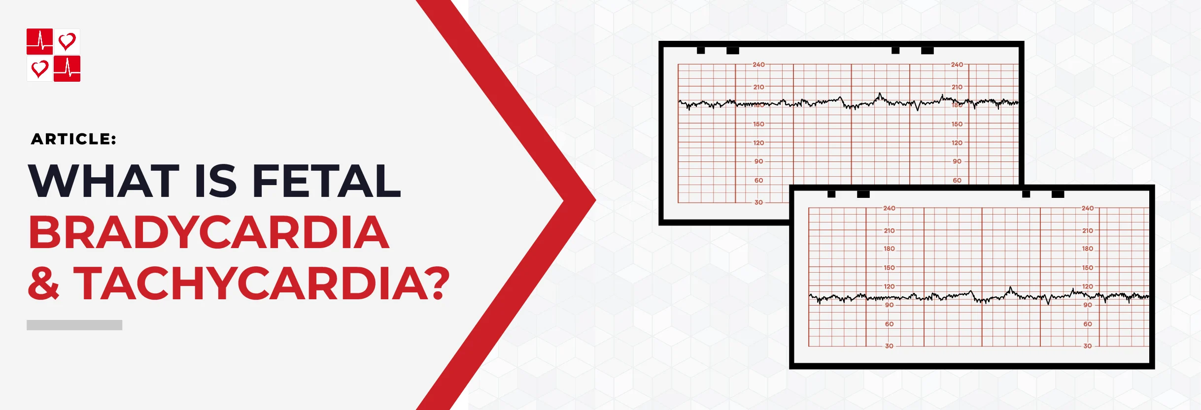 What-is-Fetal-Bradycardia-Tachycardia_TitleGraphic (3)