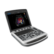 Chison Sonobook 6 Ultrasound Machine with a 15" LED HD Monitor, full keyboard and shortcut keys.