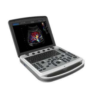 Chison Sonobook 6 Ultrasound Machine with a 15" LED HD Monitor, full keyboard and shortcut keys.