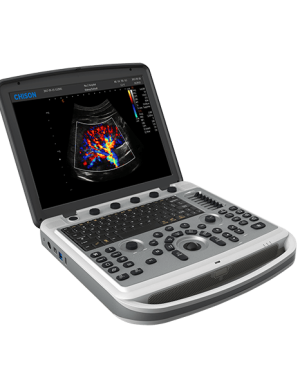 Chison SonoBook 6 Ultrasound Machine