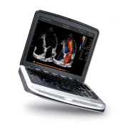 Chison SonoBook 8 Ultrasound Machine