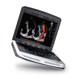 Chison SonoBook 8 Ultrasound Machine