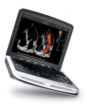 Chison SonoBook 8 Ultrasound Machine