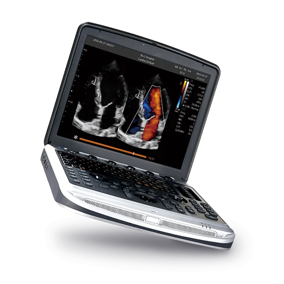 Chison SonoBook 8 Ultrasound Machine