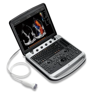 Chison SonoBook 9 Ultrasound Machine