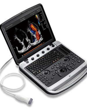 Chison SonoBook 9 Ultrasound Machine