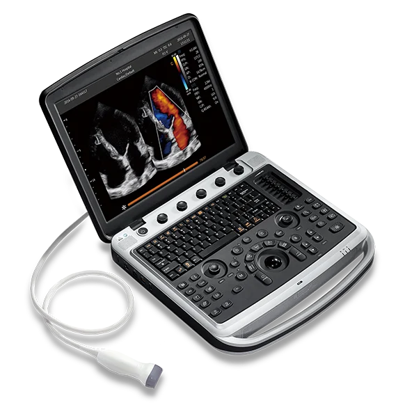 Chison SonoBook 9 Ultrasound Machine