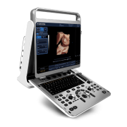 Chison EBit 30 Portable Ultrasound Machine