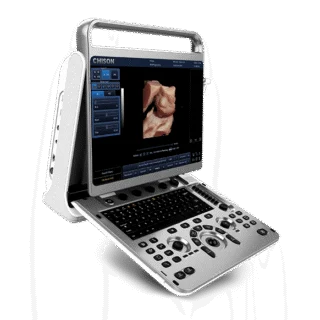 Chison EBit 30 Portable Ultrasound Machine