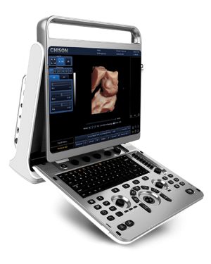 Chison EBit 30 Portable Ultrasound Machine