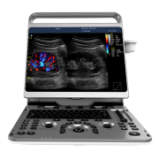 Chison EBit 50 Portable Ultrasound Machine