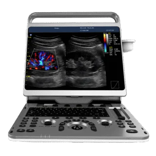 Chison EBit 50 Portable Ultrasound Machine