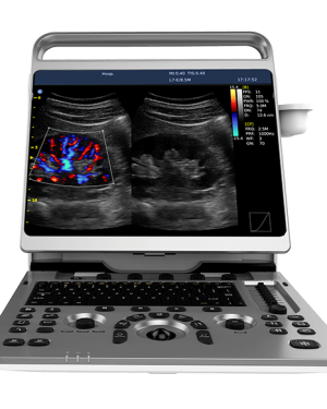 Chison EBit 50 Portable Ultrasound Machine