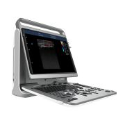 Chison EBit 50 Portable Ultrasound Machine