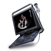 Chison EBit 60 Portable Ultrasound Machine