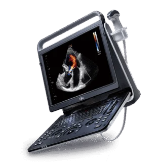 Chison EBit 60 Portable Ultrasound Machine