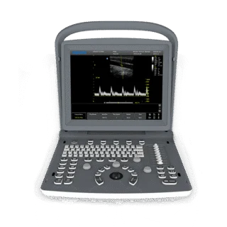 Chison ECO 2 Portable Ultrasound Machine