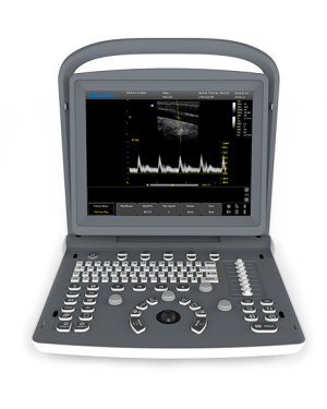Chison ECO 2 Portable Ultrasound Machine