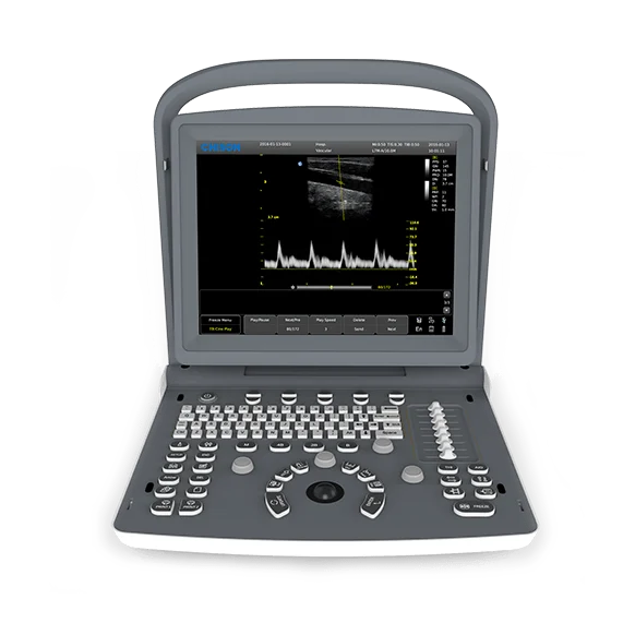 Chison ECO 2 Portable Ultrasound Machine