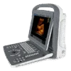Chison ECO 2 Portable Ultrasound Machine