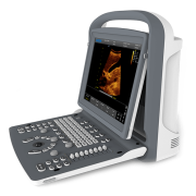 Chison ECO 2 Portable Ultrasound Machine