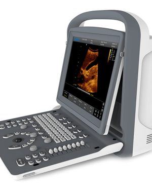 Chison ECO 2 Portable Ultrasound Machine