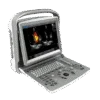 Chison ECO 6 Portable Ultrasound Machine