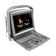 Chison ECO 6 Portable Ultrasound Machine