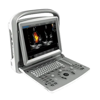 Chison ECO 6 Portable Ultrasound Machine